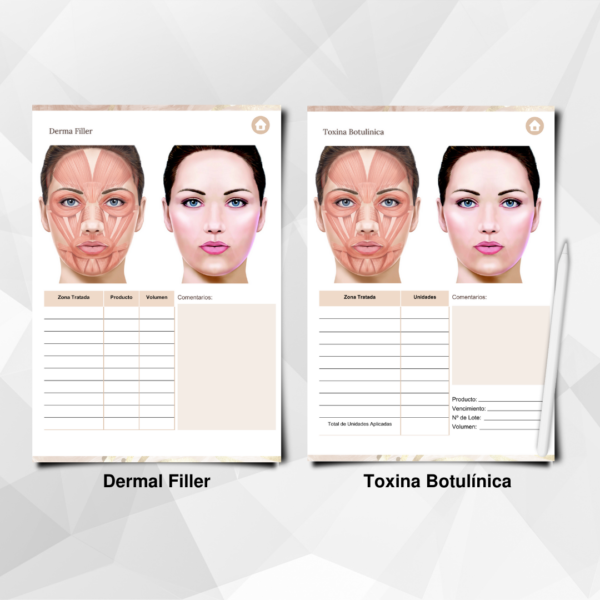 Ficha editable para tratamiento de botox y fillers